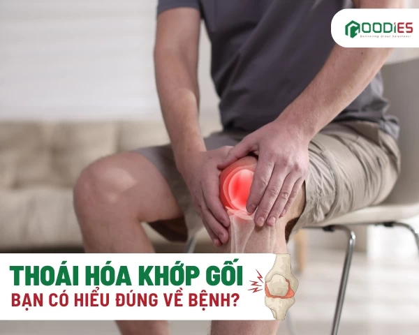 BẠN CÓ HIỂU ĐÚNG VỀ THOÁI HÓA KHỚP GỐI?
