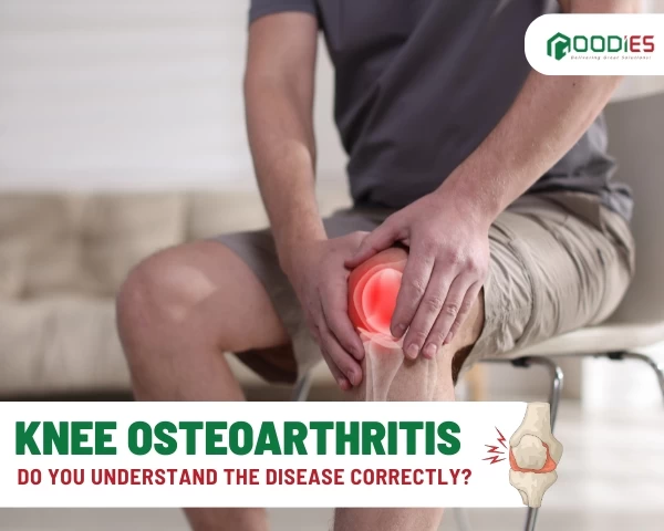 DO YOU REALLY UNDERSTAND KNEE OSTEOARTHRITIS?