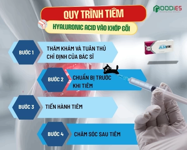 TIÊM ACID HYALURONIC (HA) VÀO KHỚP – QUY TRÌNH DIỄN RA NHƯ THẾ NÀO?