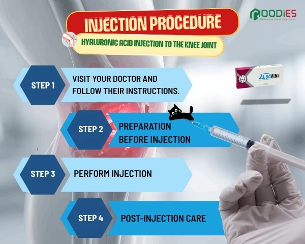 HYALURONIC ACID (HA) JOINT INJECTION – WHAT DOES THE PROCEDURE INVOLVE?