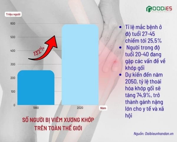 THOÁI HÓA KHỚP GỐI ĐANG “TRẺ HÓA” NHANH CHÓNG