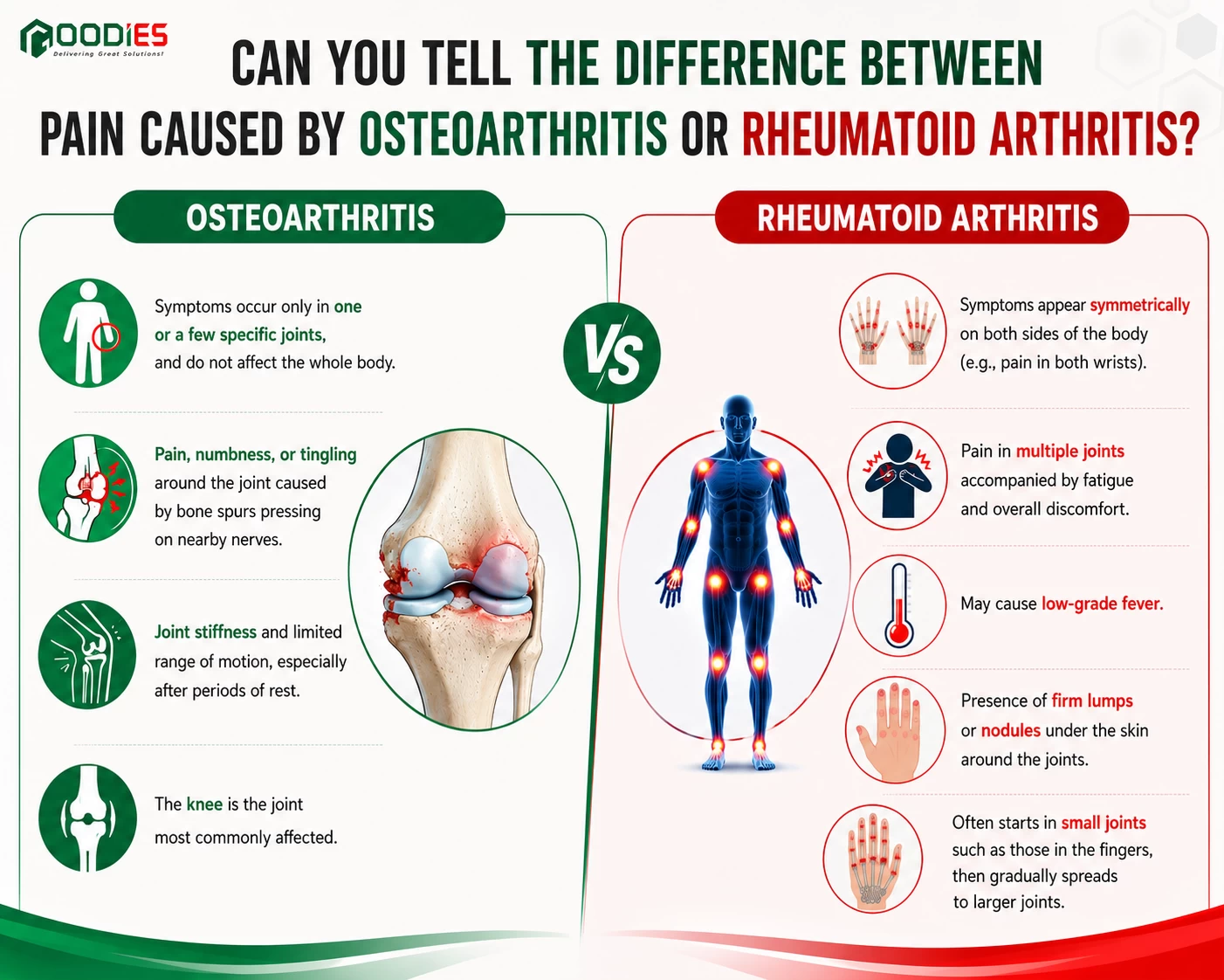 PERSISTENT JOINT PAIN: OSTEOARTHRITIS OR RHEUMATOID ARTHRITIS?
